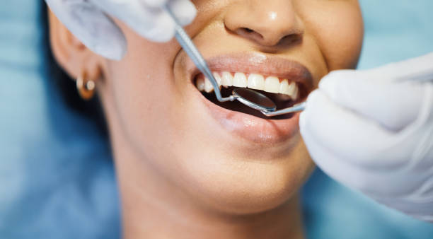 Best Emergency Tooth Extraction in Springfield, SD