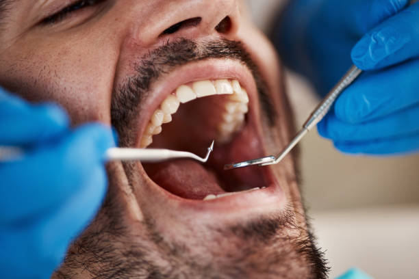 Best Pediatric Emergency Dentist in Springfield, SD